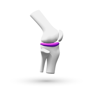 Selaa reumatologia -terapialueeseen liittyviä materiaaleja, webinaareja ja tapahtumia.